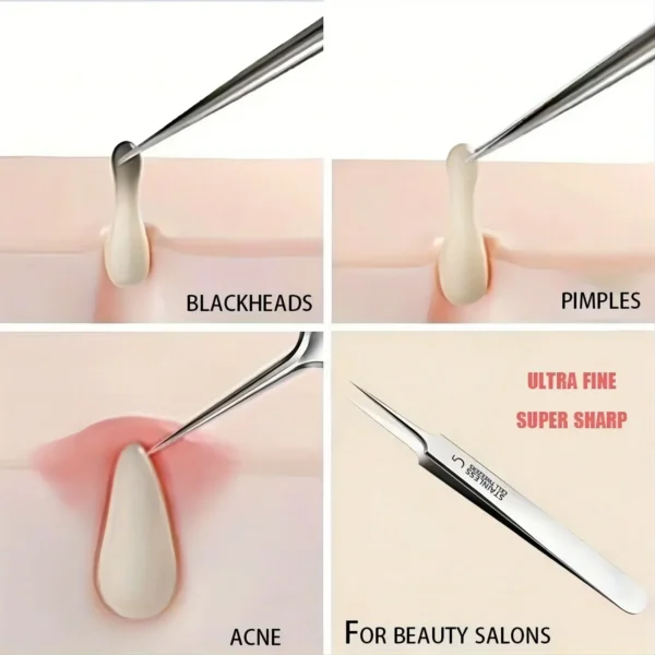 1 Pack Extra Fine No. 5 Cellular Acne Blackhead Tweezers - Facial Beauty Remove Acne Needle Tools for Skin Care - Image 5